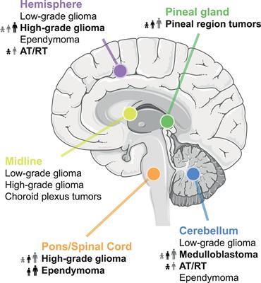 Targeting MYCN in Molecularly Defined Malignant Brain Tumors